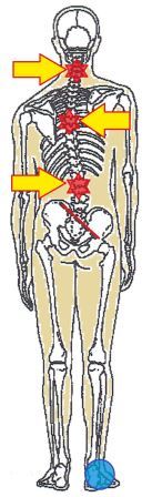 ゆがみと痛みの関係について