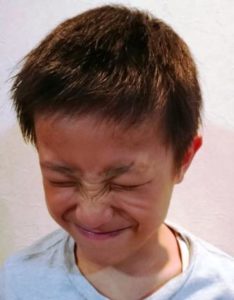 チック症 トゥレット症候群 の原因 治療と改善例